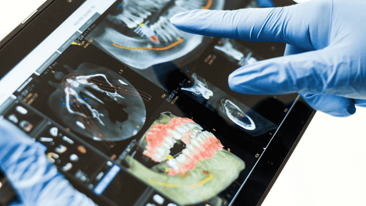 цифровая диагностика зубов 3D снимок челюсти на экране стоматолога